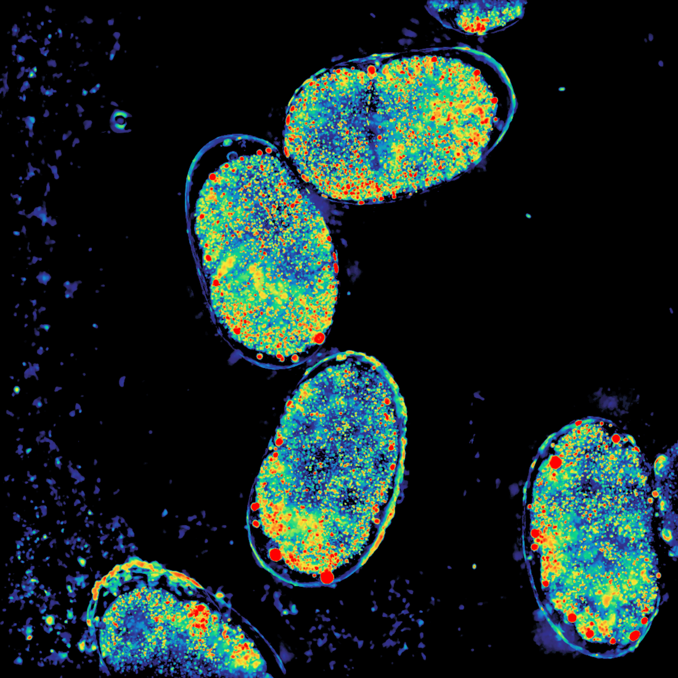 Chan Zuckerberg Initiative Gives $32 Million for Biomedical Imaging Research